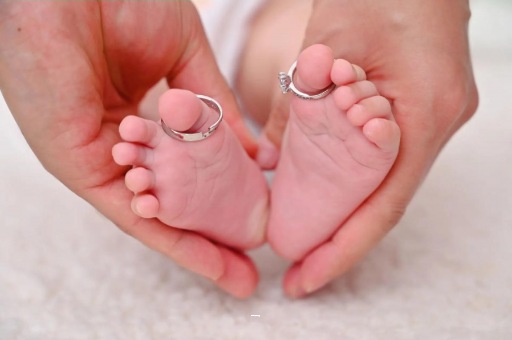 神木孕妇怎样预防妊娠纹